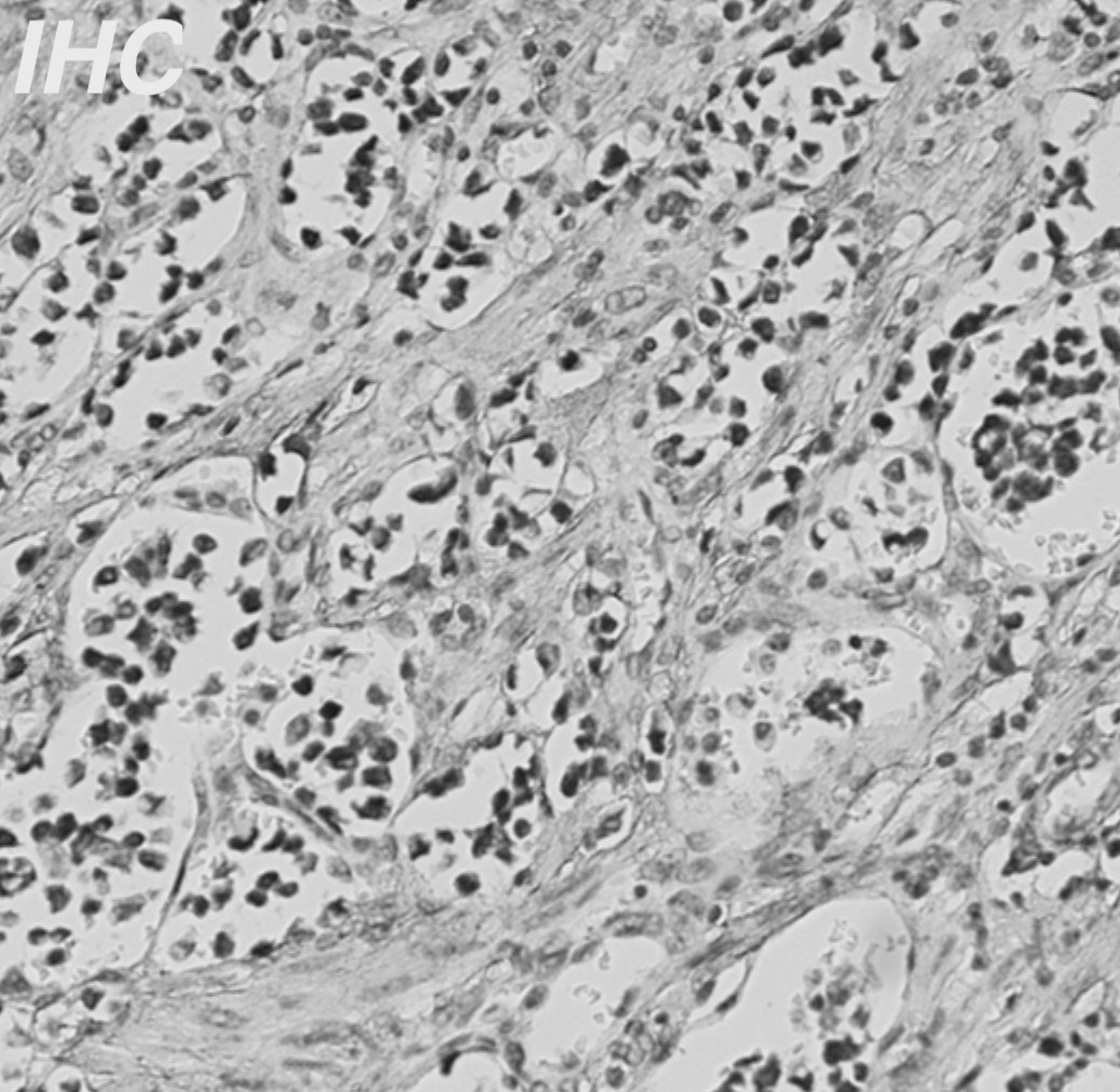 Representative immunohistochemistry image used in the ImageJ macro workflow